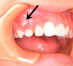 から が 見える 歯 歯茎 歯茎が下がって歯の根元が見えるのはなぜ？専門医が詳しく解説します