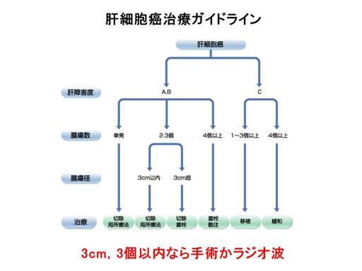 XCh摜