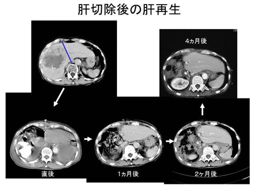 XCh摜