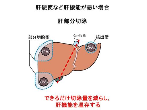 XCh摜