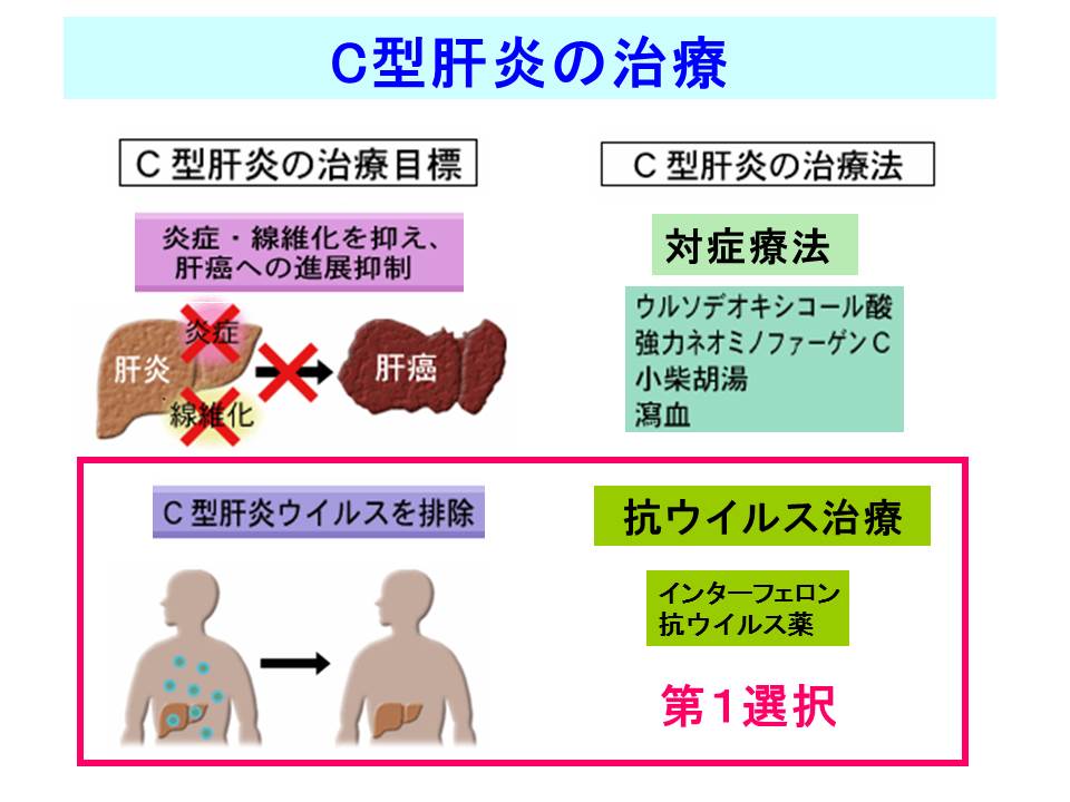 XCh摜