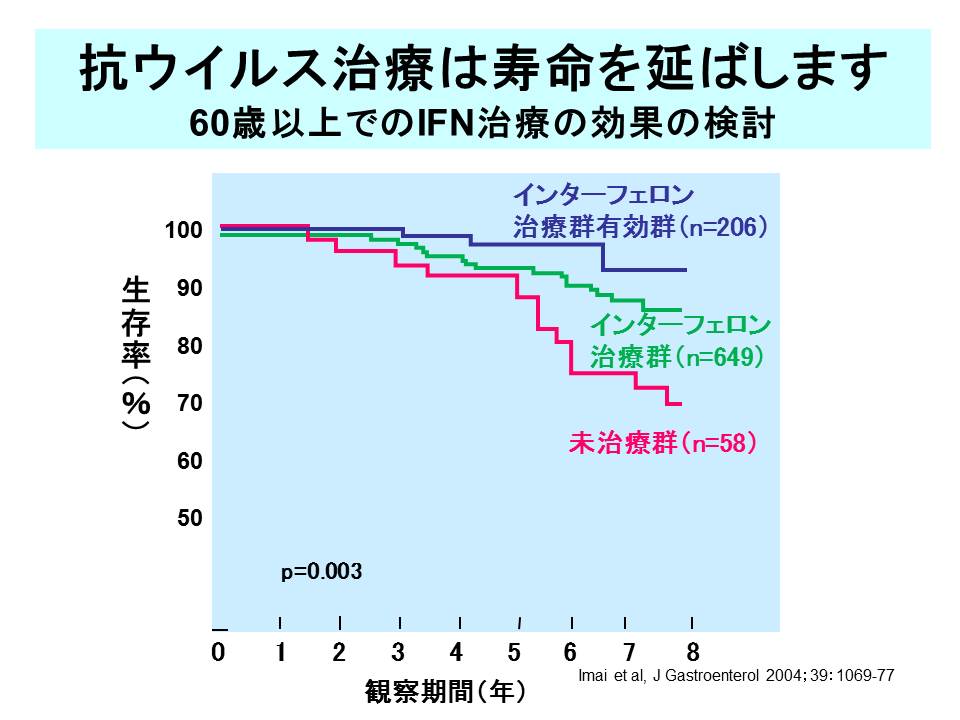 XCh摜