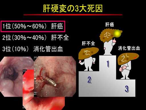 XCh摜