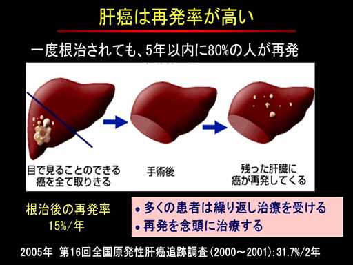 XCh摜