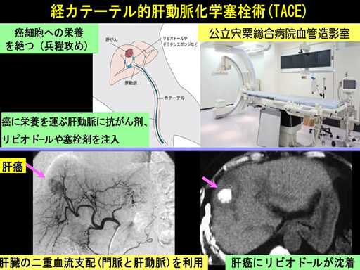 XCh摜