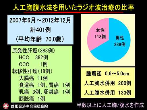 XCh摜