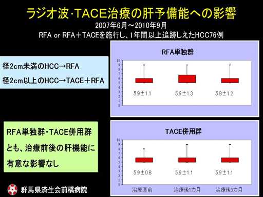 XCh摜