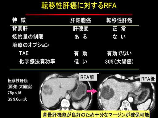 XCh摜