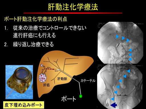 XCh摜