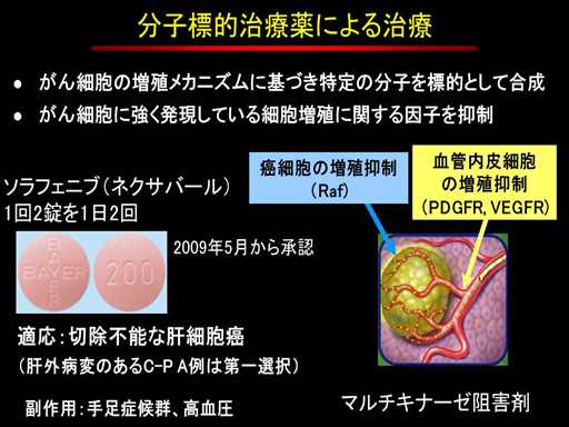 XCh摜