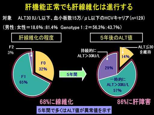 XCh摜