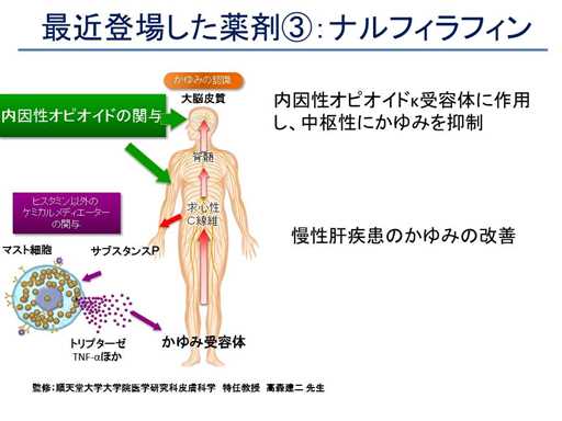 XCh摜