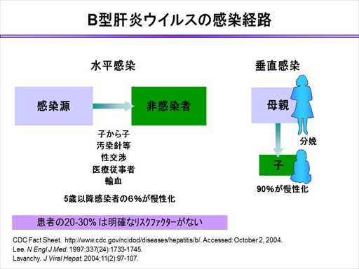 XCh摜