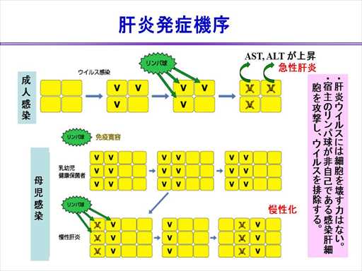 XCh摜