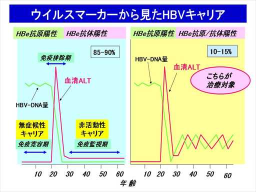 XCh摜