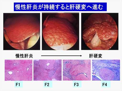 XCh摜