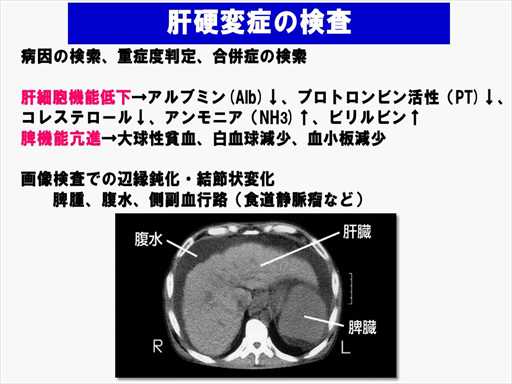 XCh摜