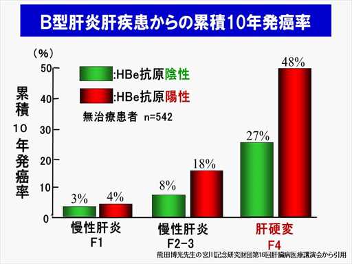 XCh摜