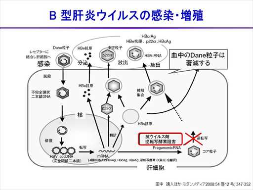 XCh摜