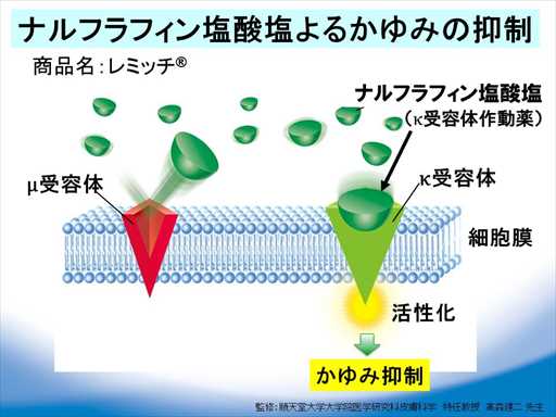 XCh摜