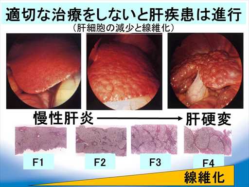 XCh摜