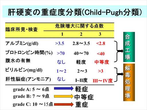 XCh摜