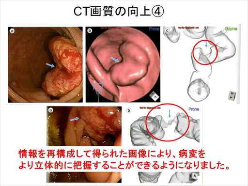 XCh摜