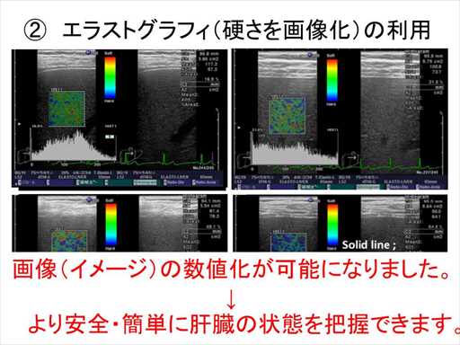 XCh摜