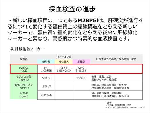 XCh摜