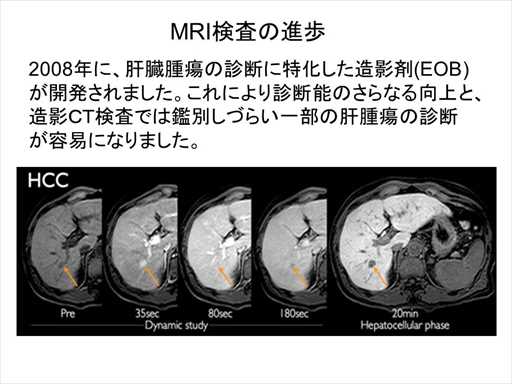 XCh摜