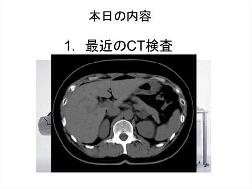 XCh摜