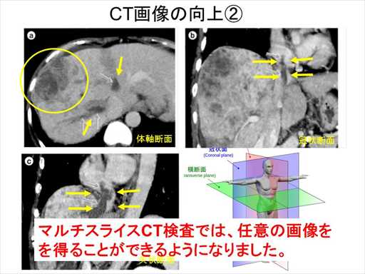 XCh摜