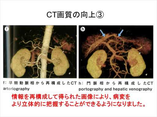 XCh摜