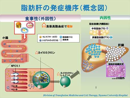 XCh摜