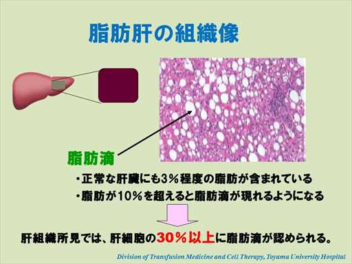 XCh摜