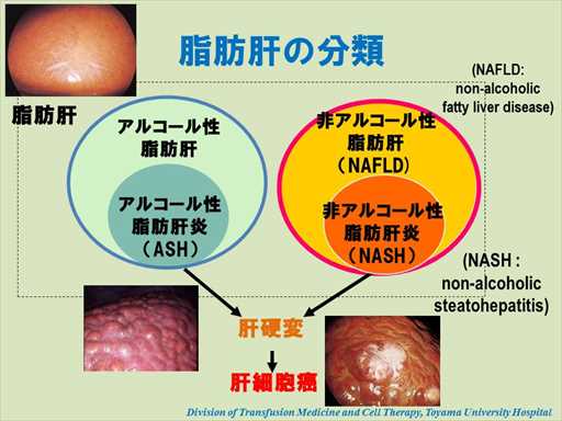 XCh摜