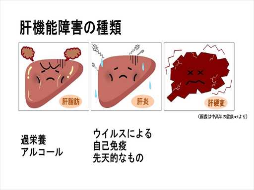 XCh摜