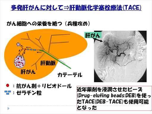 XCh摜