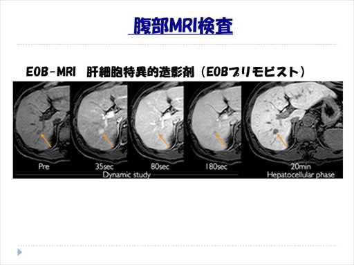 XCh摜