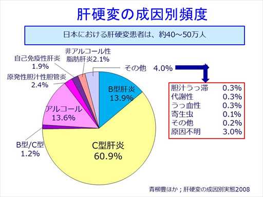 XCh摜