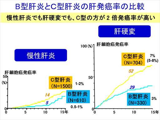 XCh摜