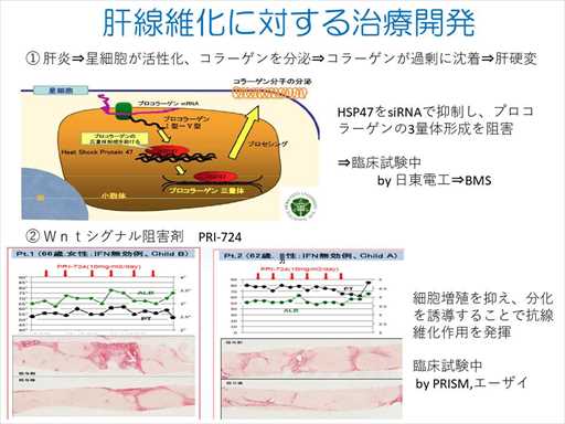 XCh摜