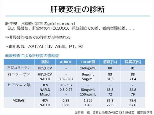 XCh摜