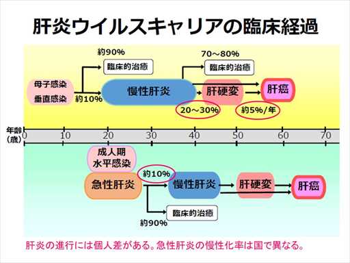 XCh摜