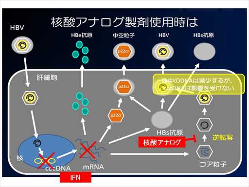 XCh摜