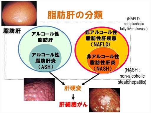 XCh摜