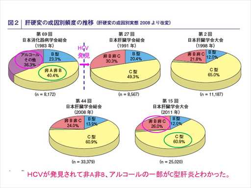 XCh摜