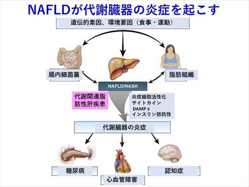 XCh摜